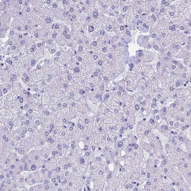 KLF14 Antibody - BSA Free Immunohistochemistry: KLF14 Antibody - BSA Free [NBP1-92058]
