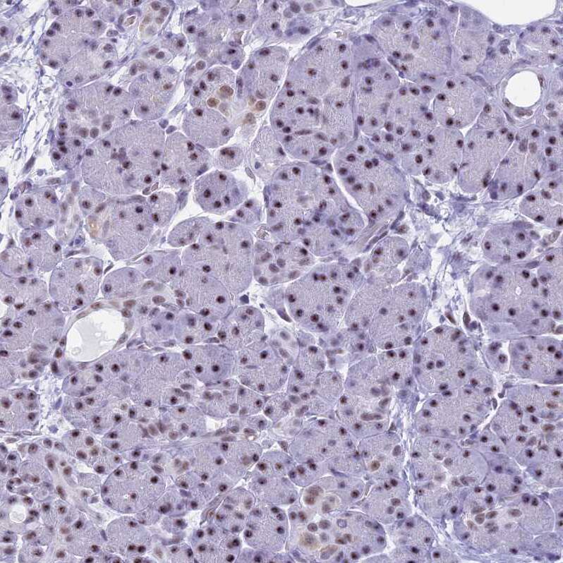 KLF14 Antibody - BSA Free Immunohistochemistry: KLF14 Antibody - BSA Free [NBP1-92058]