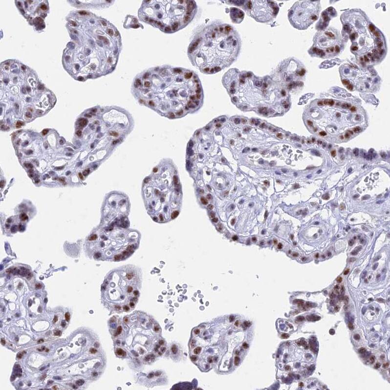 KLF14 Antibody - BSA Free Immunohistochemistry: KLF14 Antibody - BSA Free [NBP1-92058]