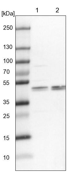 KRR1 Antibody - BSA Free Western Blot: KRR1 Antibody - BSA Free [NBP1-92060]