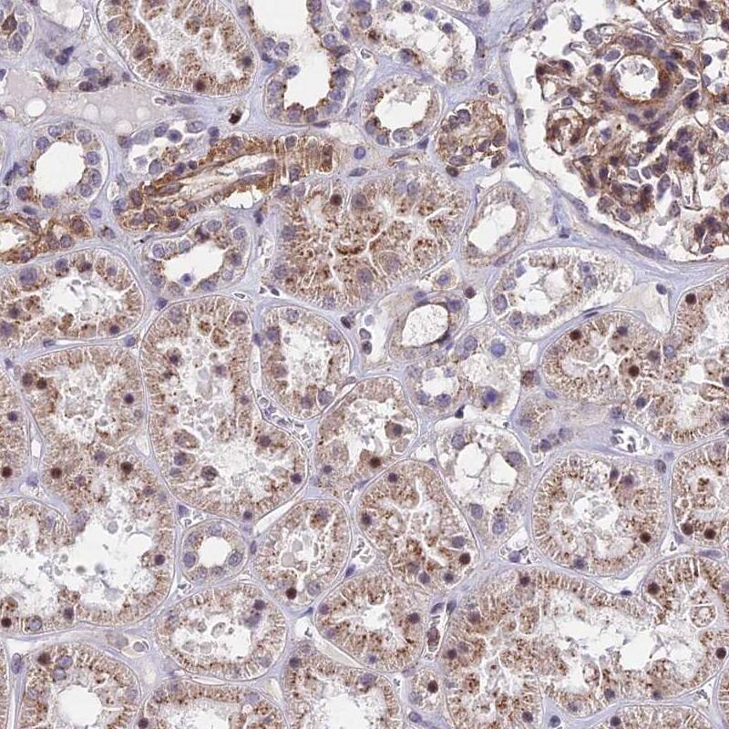 KRT222 Antibody - BSA Free Immunohistochemistry: KRT222 Antibody - BSA Free [NBP1-92061]