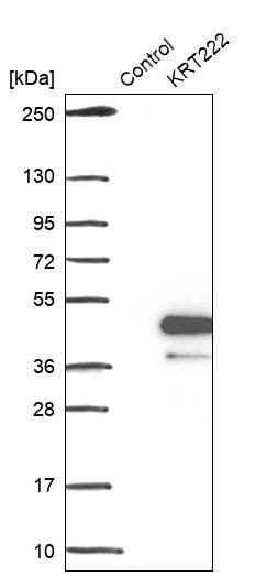 KRT222 Antibody - BSA Free Western Blot: KRT222 Antibody - BSA Free [NBP1-92061]