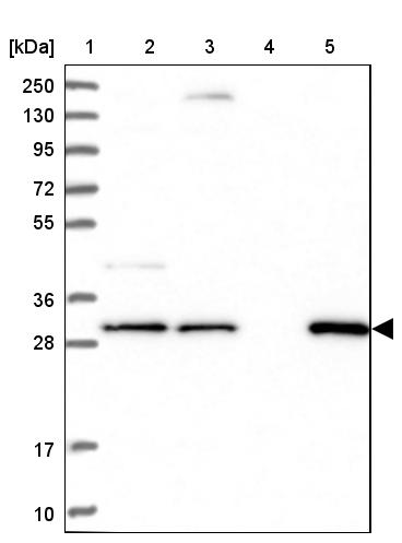 lactamase, beta 2 Antibody - BSA Free Western Blot: lactamase, beta 2 Antibody - BSA Free [NBP1-92064]