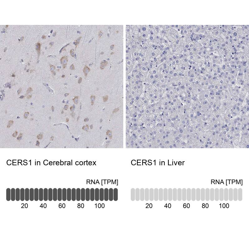 LASS1 Antibody - BSA Free Immunohistochemistry: LASS1 Antibody - BSA Free [NBP1-92067]