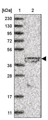lipoyltransferase 1 Antibody - BSA Free Western Blot: lipoyltransferase 1 Antibody - BSA Free [NBP1-92073]