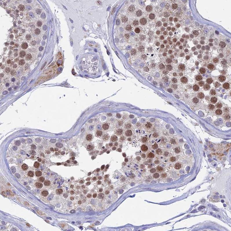 REXO5 Antibody - BSA Free Immunohistochemistry: REXO5 Antibody - BSA Free [NBP1-92075]