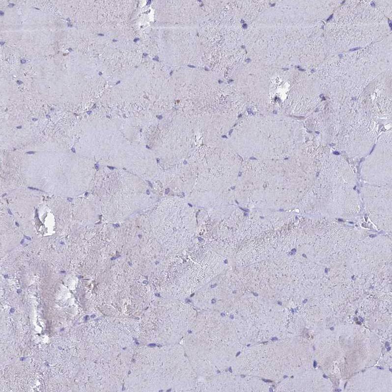 REXO5 Antibody - BSA Free Immunohistochemistry: REXO5 Antibody - BSA Free [NBP1-92075]