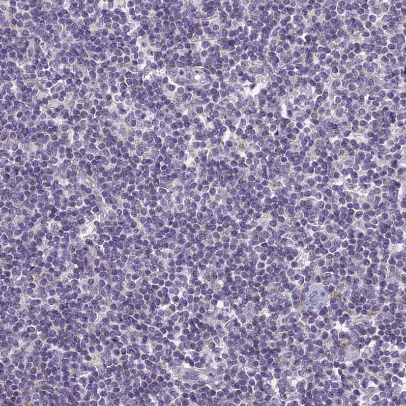 REXO5 Antibody - BSA Free Immunohistochemistry: REXO5 Antibody - BSA Free [NBP1-92075]