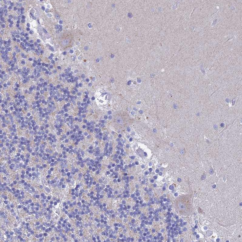 REXO5 Antibody - BSA Free Immunohistochemistry: REXO5 Antibody - BSA Free [NBP1-92075]