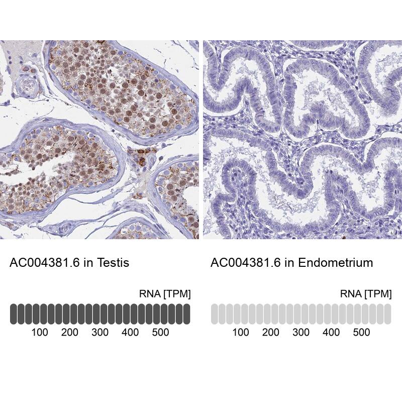 REXO5 Antibody - BSA Free Immunohistochemistry: REXO5 Antibody - BSA Free [NBP1-92076]