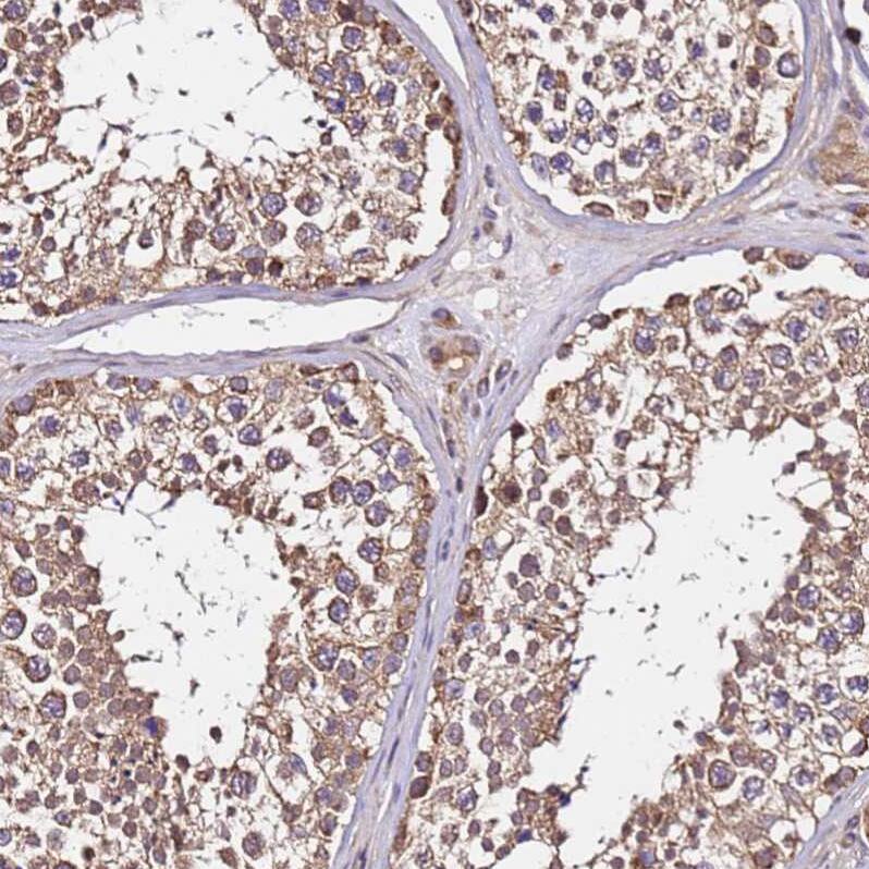 LRRIQ1 Antibody - BSA Free Immunohistochemistry: LRRIQ1 Antibody - BSA Free [NBP1-92080]