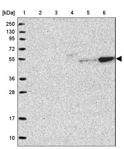 LYPLA3 Antibody - BSA Free Western Blot: LYPLA3 Antibody - BSA Free [NBP1-92089]