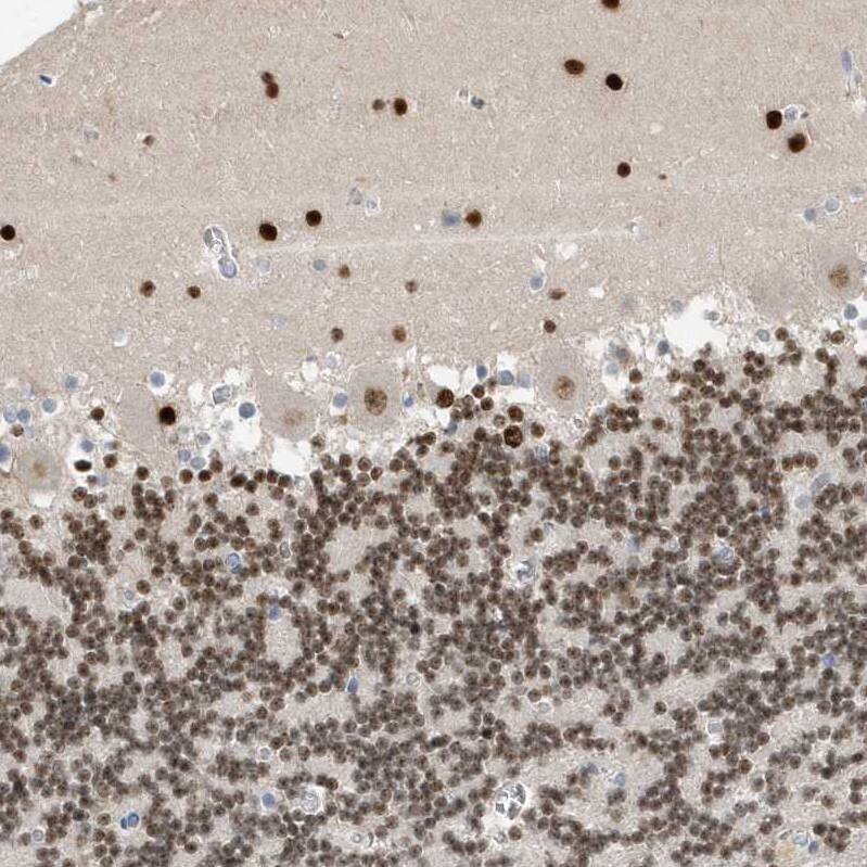 Macro H2A.2 Antibody - BSA Free Immunohistochemistry: Macro H2A.2 Antibody - BSA Free [NBP1-92094]