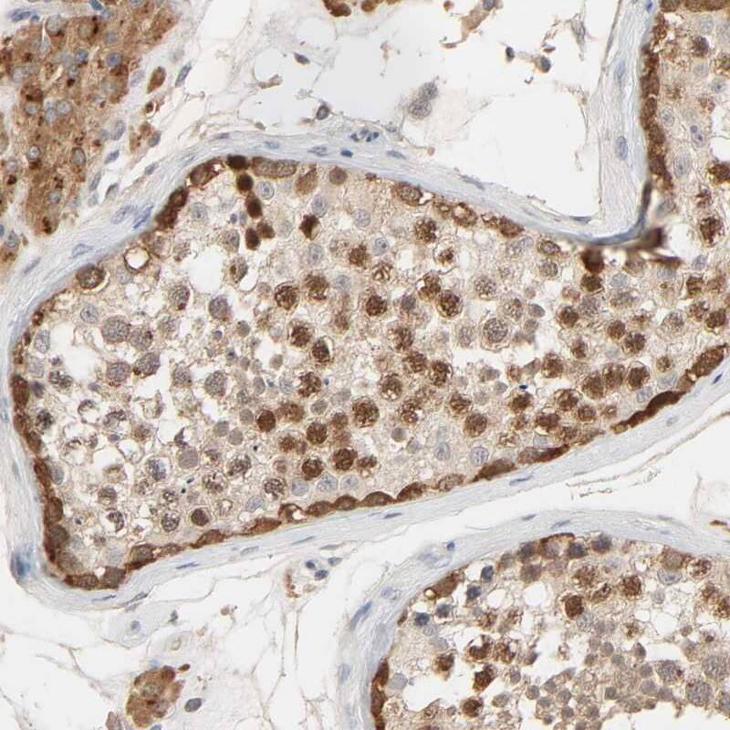 MAGEA8 Antibody - BSA Free Immunohistochemistry: MAGEA8 Antibody - BSA Free [NBP1-92097]