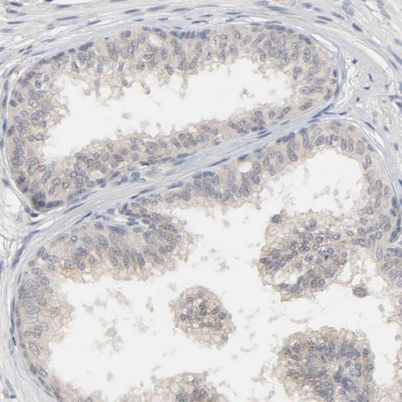 MAGEA8 Antibody - BSA Free Immunohistochemistry: MAGEA8 Antibody - BSA Free [NBP1-92097]