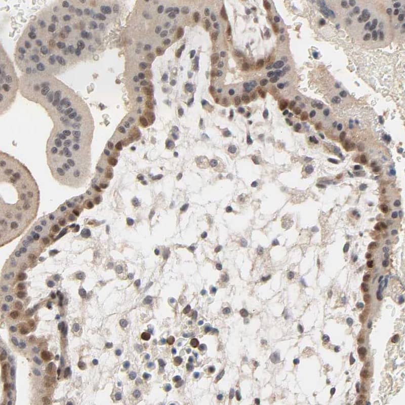 MAGEA8 Antibody - BSA Free Immunohistochemistry: MAGEA8 Antibody - BSA Free [NBP1-92097]