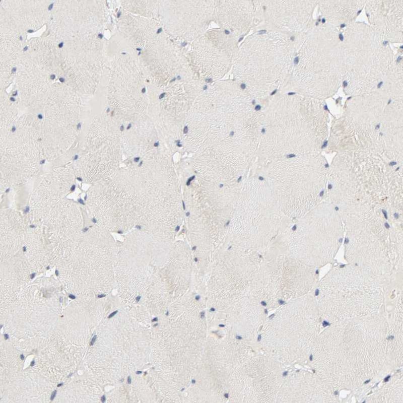 MAGEA8 Antibody - BSA Free Immunohistochemistry: MAGEA8 Antibody - BSA Free [NBP1-92097]