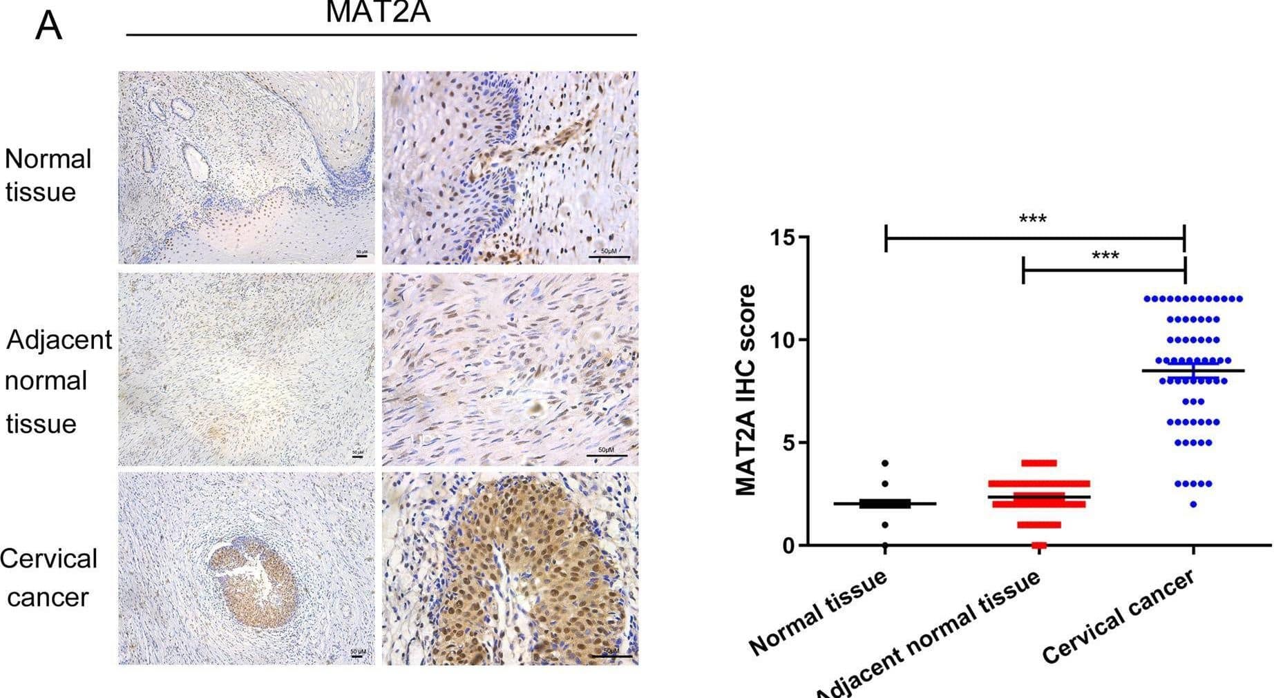 MAT2A Antibody - BSA Free
