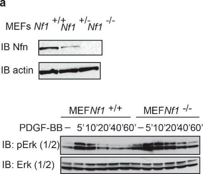 Neurofibromin 1 Antibody - BSA Free