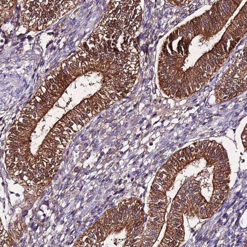 MB21D2 Antibody - BSA Free Immunohistochemistry: MB21D2 Antibody - BSA Free [NBP1-92101]