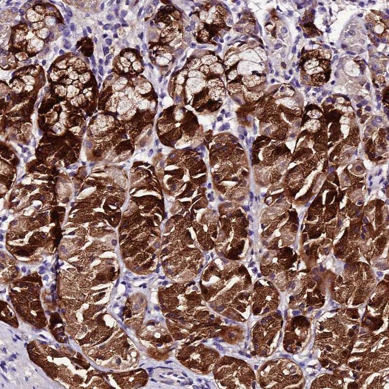 MB21D2 Antibody - BSA Free Immunohistochemistry: MB21D2 Antibody - BSA Free [NBP1-92101]