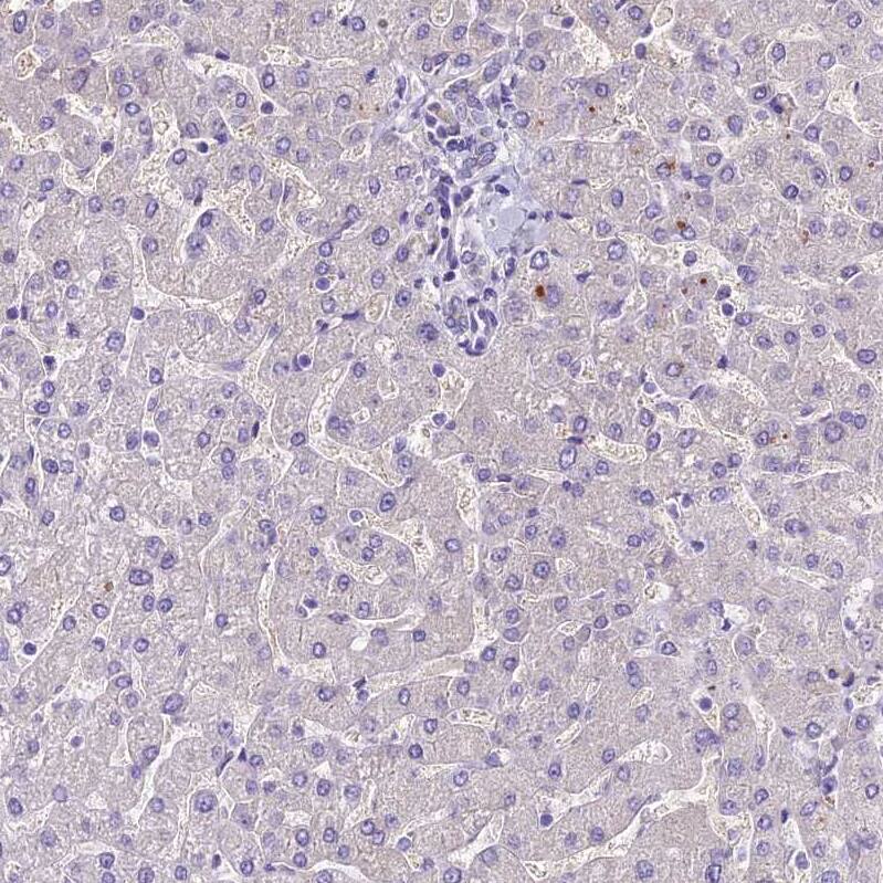 MB21D2 Antibody - BSA Free Immunohistochemistry: MB21D2 Antibody - BSA Free [NBP1-92101]