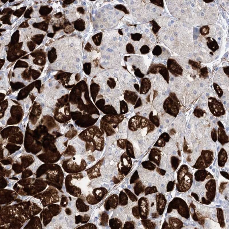 Methionyl tRNA synthetase 2 Antibody - BSA Free Immunohistochemistry-Paraffin: Methionyl tRNA synthetase 2 Antibody [NBP1-92106]