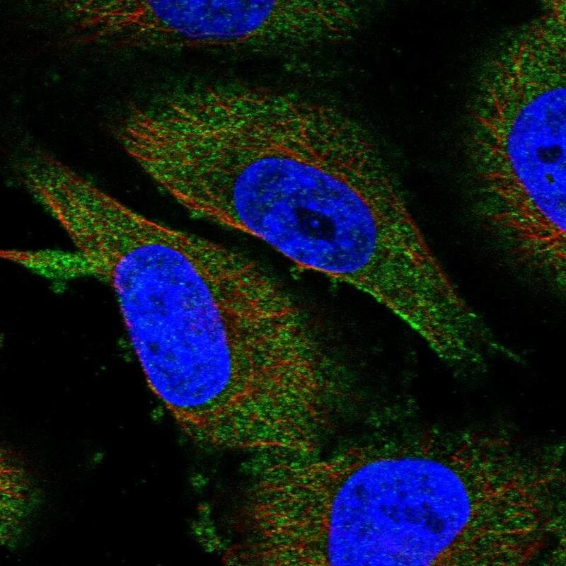 METTL13 Antibody - BSA Free Immunocytochemistry/ Immunofluorescence: METTL13 Antibody - BSA Free [NBP1-92109]