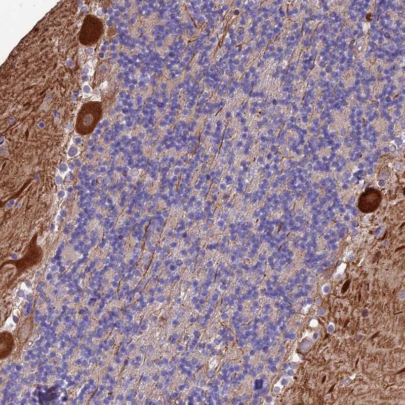 MFSD2 Antibody - BSA Free Immunohistochemistry: MFSD2 Antibody - BSA Free [NBP1-92112]