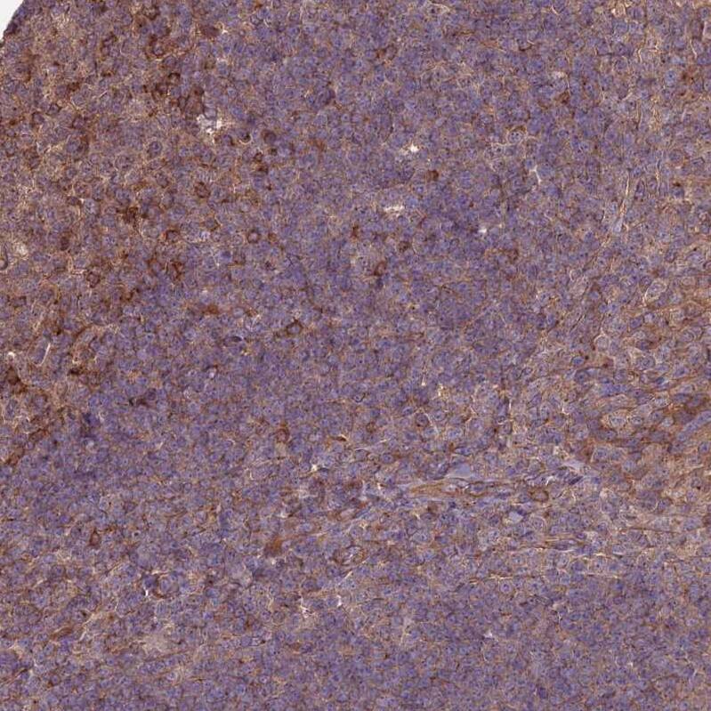 MFSD8 Antibody - BSA Free Immunohistochemistry: MFSD8 Antibody - BSA Free [NBP1-92114]