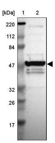 MGC13138 Antibody - BSA Free Western Blot: MGC13138 Antibody - BSA Free [NBP1-92115]