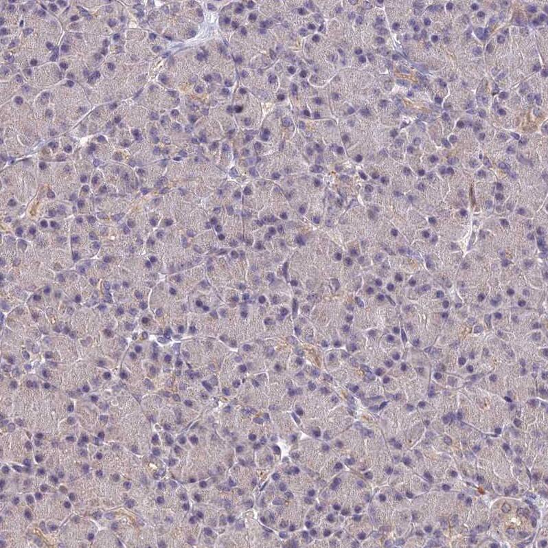 APBA3/Mint-3 Antibody - BSA Free Immunohistochemistry: APBA3/Mint-3 Antibody - BSA Free [NBP1-92117]