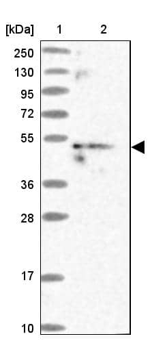 MKKS Antibody - BSA Free Western Blot: MKKS Antibody - BSA Free [NBP1-92122]