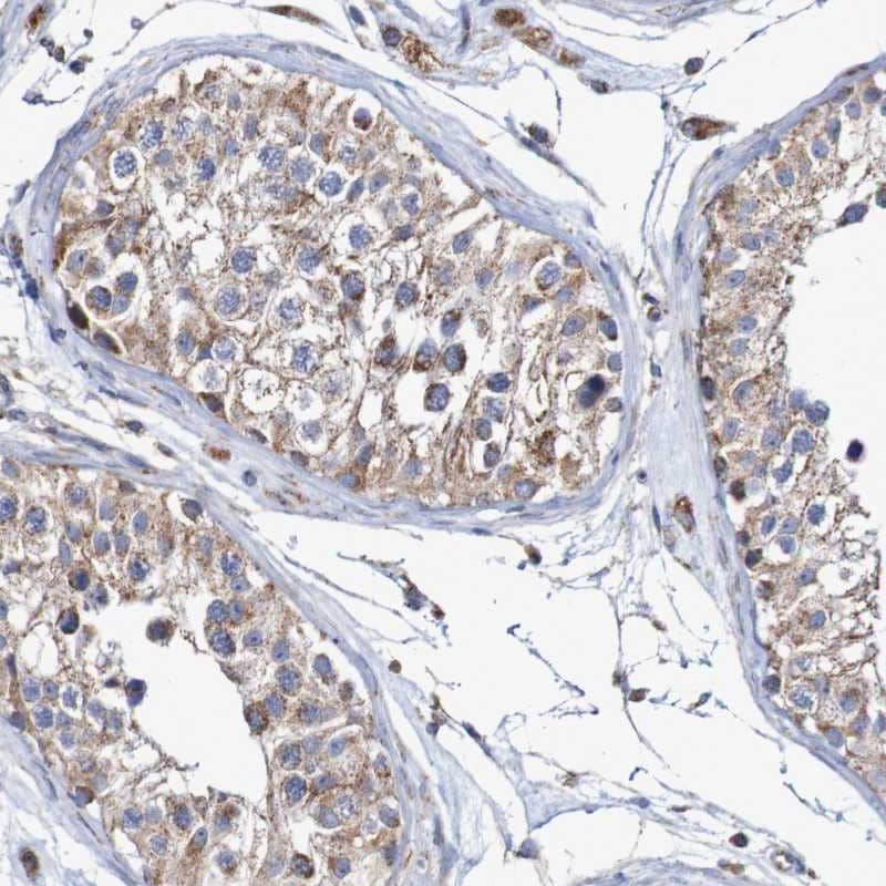 Neprilysin-2/MMEL1 Antibody - BSA Free Immunohistochemistry: Neprilysin-2/MMEL1 Antibody - BSA Free [NBP1-92125]
