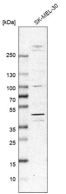 MNK2 Antibody - BSA Free Western Blot: MNK2 Antibody - BSA Free [NBP1-92129]