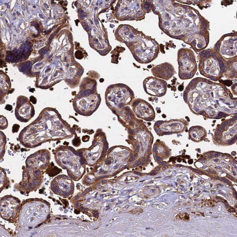 MOCS1 Antibody - BSA Free Immunohistochemistry: MOCS1 Antibody - BSA Free [NBP1-92130]