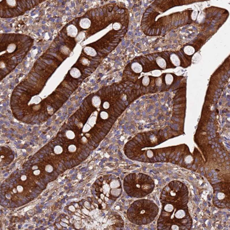 MOCS1 Antibody - BSA Free Immunohistochemistry: MOCS1 Antibody - BSA Free [NBP1-92130]