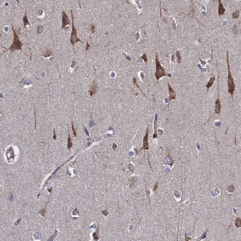 MOCS1 Antibody - BSA Free Immunohistochemistry: MOCS1 Antibody - BSA Free [NBP1-92130]
