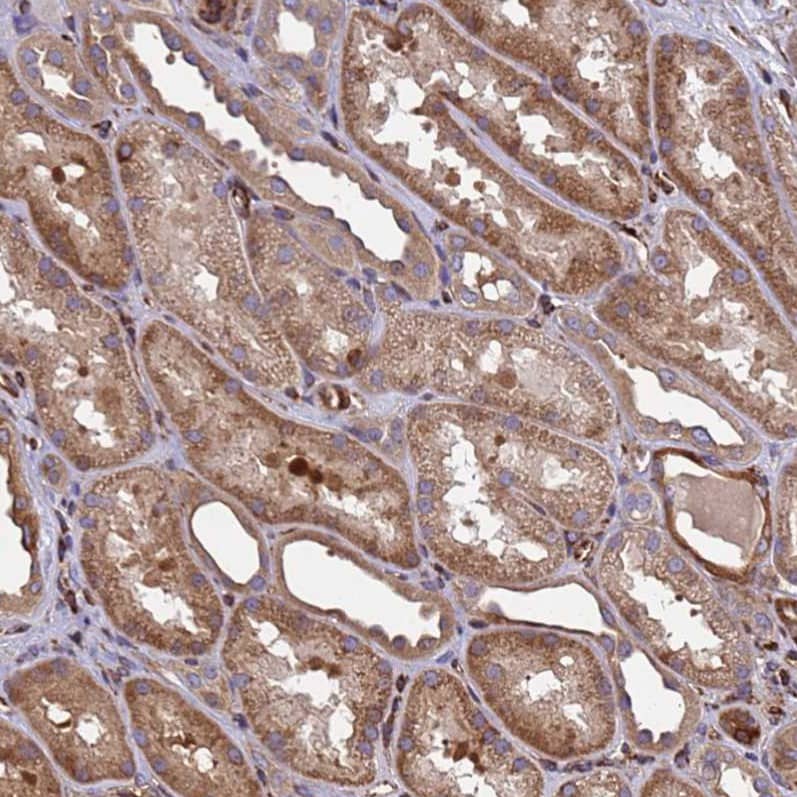 MOCS1 Antibody - BSA Free Immunohistochemistry: MOCS1 Antibody - BSA Free [NBP1-92130]
