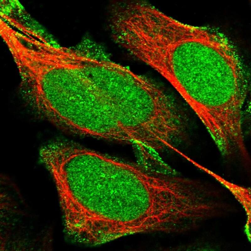 mpp8 Antibody - BSA Free Immunocytochemistry/ Immunofluorescence: mpp8 Antibody [NBP1-92135]
