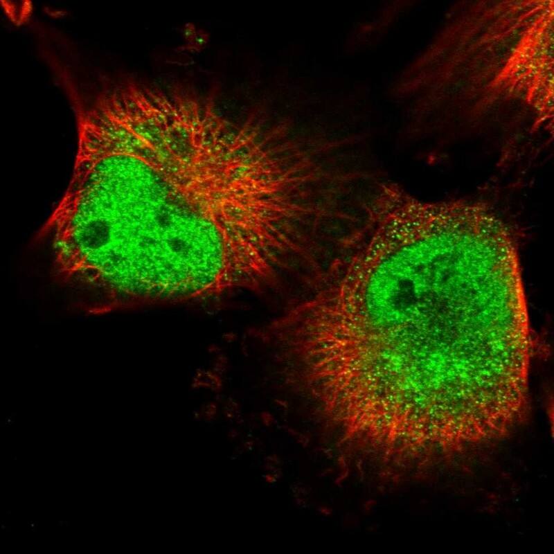 mpp8 Antibody - BSA Free Immunocytochemistry/ Immunofluorescence: mpp8 Antibody [NBP1-92136]