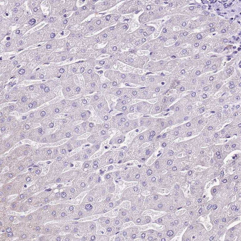 MRPL36 Antibody - BSA Free Immunohistochemistry: MRPL36 Antibody - BSA Free [NBP1-92139]