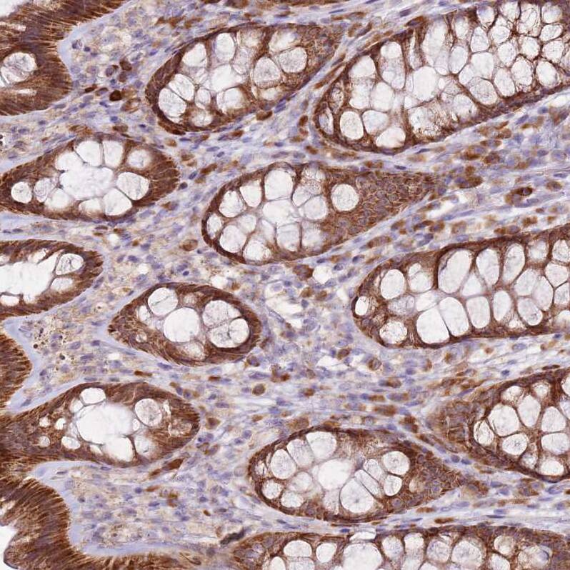 MRPL36 Antibody - BSA Free Immunohistochemistry: MRPL36 Antibody - BSA Free [NBP1-92139]