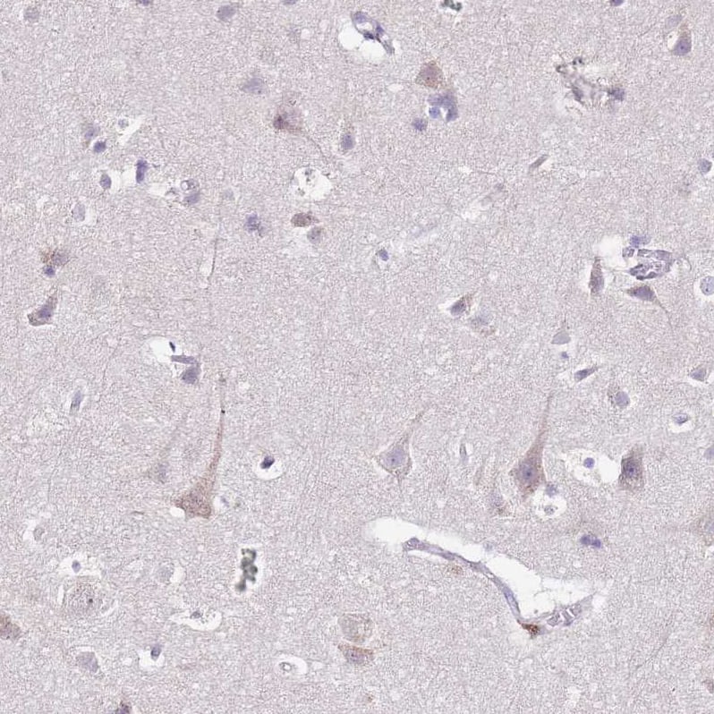 MRPL36 Antibody - BSA Free Immunohistochemistry: MRPL36 Antibody - BSA Free [NBP1-92139]