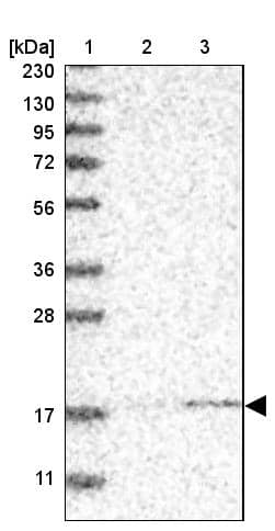 MRPS24 Antibody - BSA Free Western Blot: MRPS24 Antibody - BSA Free [NBP1-92140]