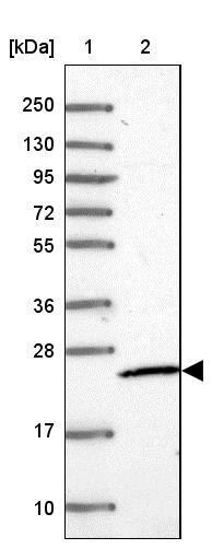 MRPS26 Antibody - BSA Free Western Blot: MRPS26 Antibody - BSA Free [NBP1-92141]