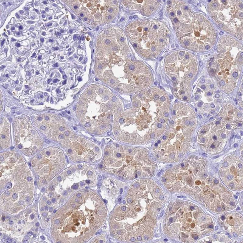 MS4A13 Antibody - BSA Free Immunohistochemistry: MS4A13 Antibody - BSA Free [NBP1-92142]
