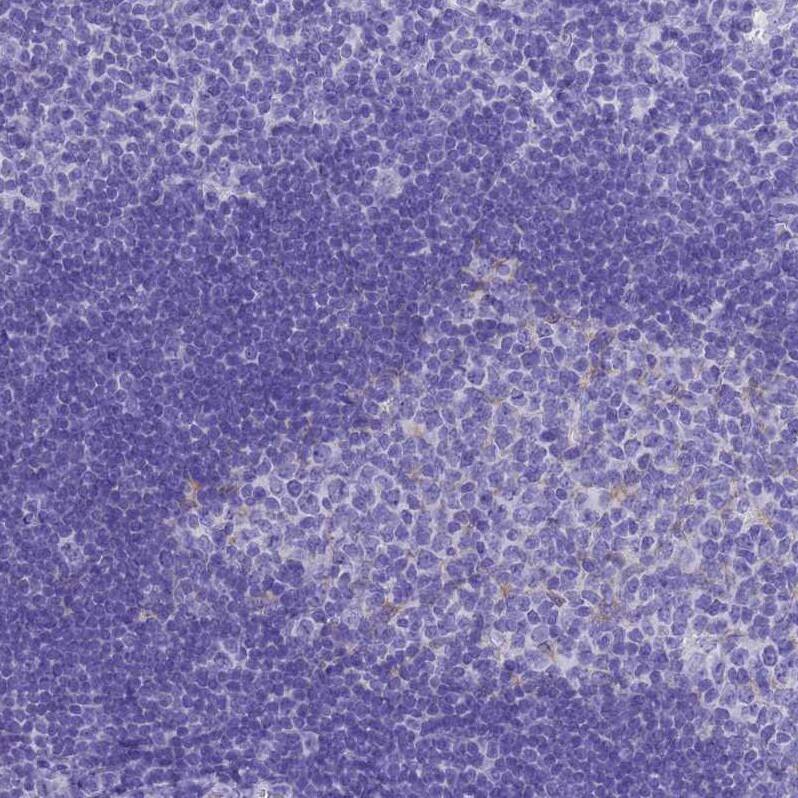 MS4A13 Antibody - BSA Free Immunohistochemistry: MS4A13 Antibody - BSA Free [NBP1-92142]