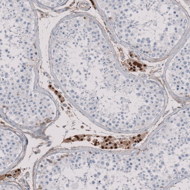 MS4A13 Antibody - BSA Free Immunohistochemistry: MS4A13 Antibody - BSA Free [NBP1-92142]
