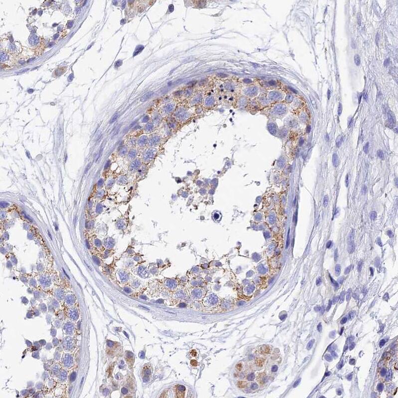 MS4A5 Antibody - BSA Free Immunohistochemistry: MS4A5 Antibody - BSA Free [NBP1-92143]